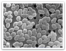 Entérocoques résistants à la vancomycine (ERV) (Enterococcus spp.)